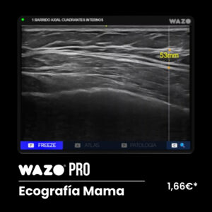WAZO® PRO – Mama