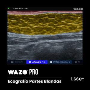 WAZO® PRO – Partes Blandas