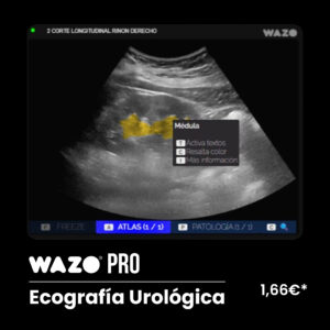 WAZO® PRO – Urológica