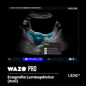 WAZO PRO – MSK LUMBOPÉLVICA – TÉCNICA RUSI