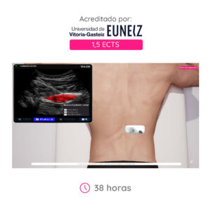 Curso de Ecografía MSK Lumbopélvica - Técnica RUSI